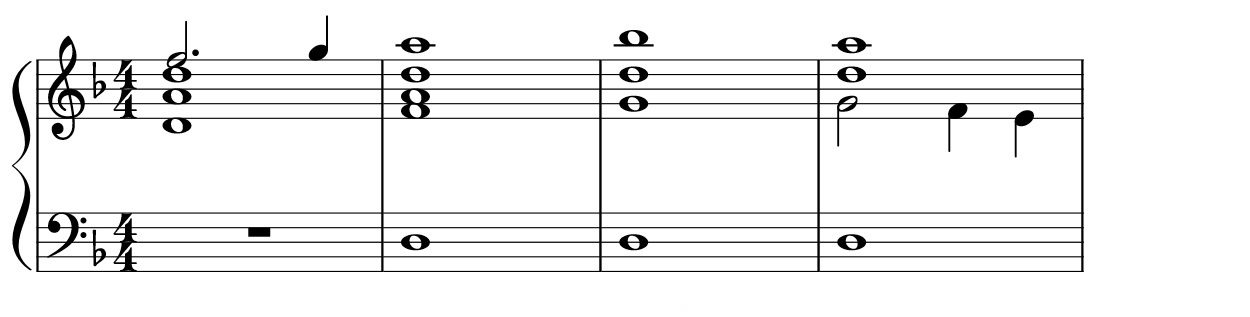 Toccata 28